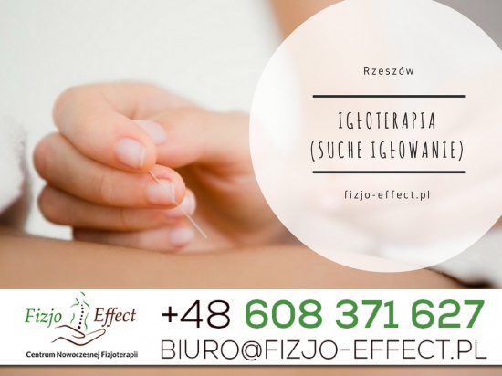 Igłoterapia mięśniowo-powięziowych punktów spustowych Rzeszów - S